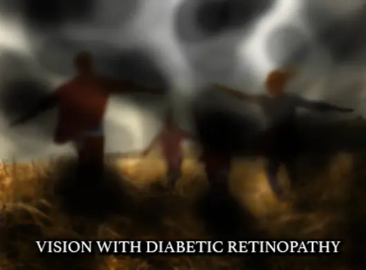 Symptoms of Diabetic Retinopathy